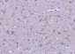 Calmodulin 1/2/3 Rabbit pAb